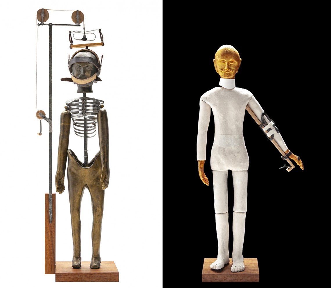 Originalgetreue Nachbauten von zwei sogenannten Heine-Puppen zur Veranschaulichung von orthopädischen Erkrankungen und Therapiemethoden