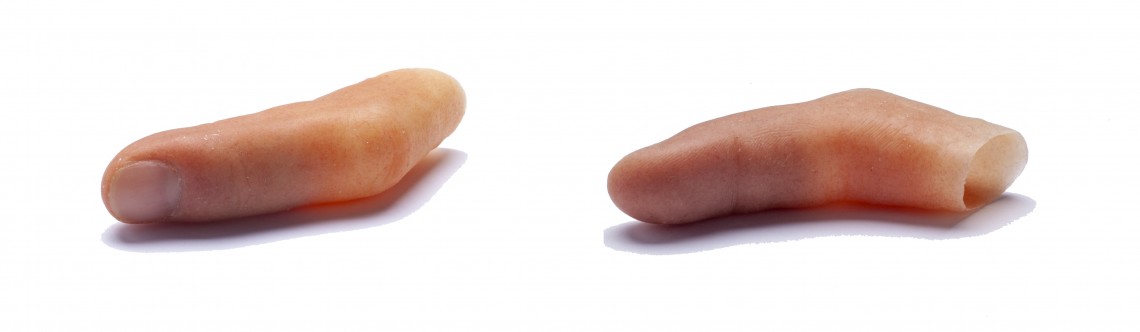 Zwei täuschend echt aussehende Fingerprothesen aus Silikonkautschuk zur visuellen Korrektur des Verlusts eines Fingers